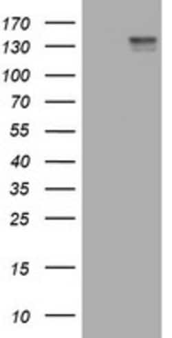 KIT Mouse anti-Human, Clone: OTI1E2, lyophilized, TrueMAB 100 &mu;g; Unconjugated:Antibodies,