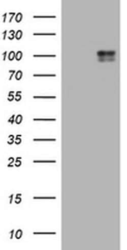 KIT Monoclonal Antibody (OTI2C1D5), TrueMAB , OriGene 100 &mu;L; Unconjugated:Antibodies,