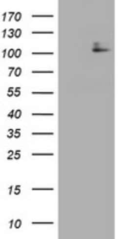 KIT Mouse anti-Human, Clone: OTI2B5, lyophilized, TrueMAB 100 &mu;g; Unconjugated:Antibodies,