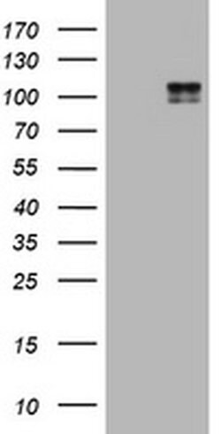KIT Monoclonal Antibody (OTI9A11), TrueMAB , OriGene 100 &mu;L; Unconjugated:Antibodies,