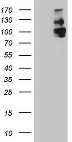KIT Monoclonal Antibody (OTI14B1), TrueMAB , OriGene:Antibodies:Primary