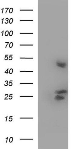 KITLG Mouse anti-Human, Clone: OTI5E9, lyophilized, TrueMAB 100 &mu;g;
