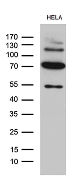 KLC2 Monoclonal Antibody (OTI10H10), TrueMAB , OriGene 100 &mu;L; Unconjugated:Antibodies,