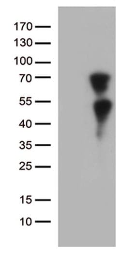 KLF11 Monoclonal Antibody (OTI2A4), TrueMAB , OriGene 100 &mu;L | Buy Online | OriGene | Fisher Scientific