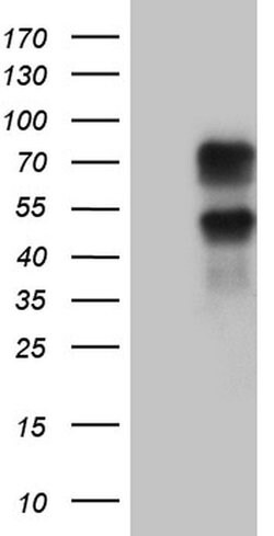 KLF11 Monoclonal Antibody (OTI4H7), TrueMAB , OriGene 100 &mu;L | Buy Online | Origene Technologies | Fisher Scientific