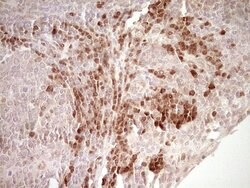 KLF2 Mouse anti-Human, Clone: OTI3A10, lyophilized, TrueMAB 100 &mu;g;