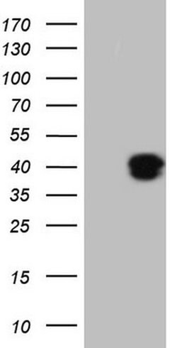 KLF2 Monoclonal Antibody (OTI5F1), TrueMAB , OriGene:Antibodies:Primary
