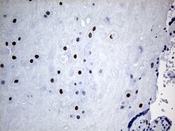 KLF5 Monoclonal Antibody (OTI2G4), TrueMAB , OriGene 100 &mu;L; Unconjugated:Antibodies,