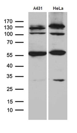 KLF5 Monoclonal Antibody (OTI1E4), TrueMAB , OriGene 100 &mu;L; Unconjugated:Antibodies,