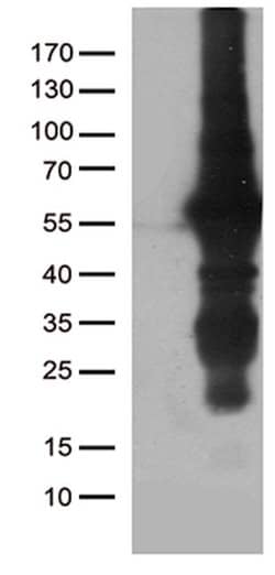 KLF5 Mouse anti-Human, Clone: OTI2G4, lyophilized, TrueMAB 100 &mu;g; Unconjugated:Antibodies,
