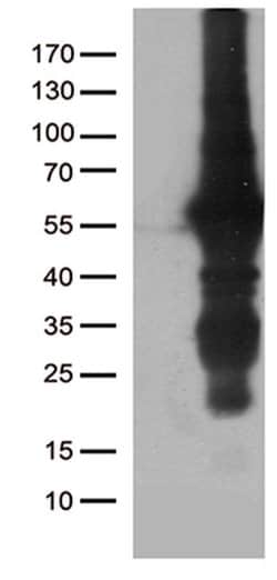 KLF5 Monoclonal Antibody (OTI2G4), TrueMAB , OriGene 100 &mu;L; Unconjugated:Antibodies,