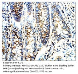 KLF6 SV1 Rabbit anti-Human, Non-human Primate, Polyclonal, FabGennix 200