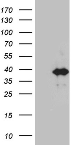 KLF7 Mouse anti-Human, Mouse, Clone: OTI8D7, liquid, TrueMAB 100 &mu;L;