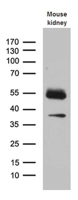 KLF7 Mouse anti-Human, Mouse, Clone: OTI8D7, liquid, TrueMAB 100 &mu;L;