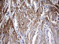 KLHL12 Monoclonal Antibody (OTI4E1), TrueMAB , OriGene 100 &mu;L; Unconjugated:Antibodies,
