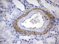 KLHL12 Monoclonal Antibody (OTI4E1), TrueMAB , OriGene:Antibodies:Primary