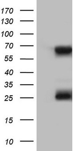 KLHL12 Monoclonal Antibody (OTI1D2), TrueMAB , OriGene:Antibodies:Primary