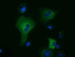 KLHL2 Monoclonal Antibody (OTI3H9), TrueMAB , OriGene:Antibodies:Primary