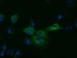 KLHL2 Mouse anti-Human, Clone: OTI10C12, lyophilized, TrueMAB 100 &mu;g;