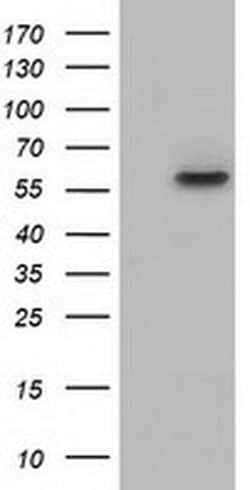 KLHL2 Monoclonal Antibody (OTI8B8), TrueMAB , OriGene 100 &mu;L; Unconjugated:Antibodies,