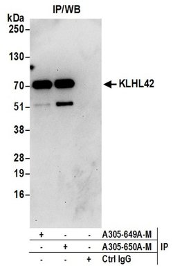 KLHL42 Polyclonal Antibody, Bethyl Laboratories 20 &mu;L; Unconjugated:Antibodies,