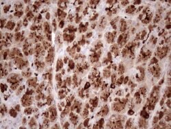 KLK3 Monoclonal Antibody (OTI2A2), TrueMAB , OriGene 100 &mu;L; Unconjugated:Antibodies,