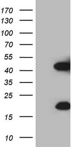 KLK3 Monoclonal Antibody (OTI3C8), TrueMAB , OriGene 30 &mu;L; Unconjugated:Antibodies,