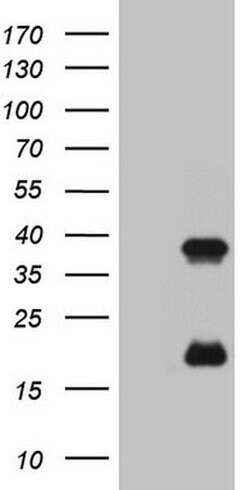 KLK3 Monoclonal Antibody (OTI3A11), TrueMAB , OriGene 100 &mu;L; Unconjugated:Antibodies,