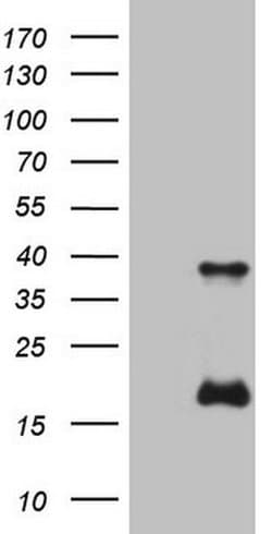 KLK3 Monoclonal Antibody (OTI2C9), TrueMAB , OriGene 30 &mu;L; Unconjugated:Antibodies,