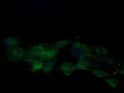 KLK8 Monoclonal Antibody (OTI6D5), TrueMAB , OriGene 100 &mu;L; Unconjugated:Antibodies,
