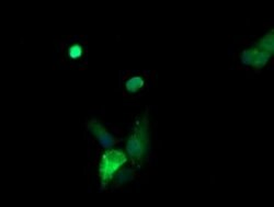 KLK8 Monoclonal Antibody (OTI1A10), TrueMAB , OriGene:Antibodies:Primary