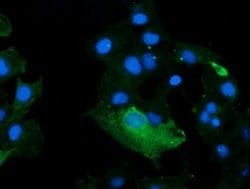 KLK8 Monoclonal Antibody (OTI10D3), TrueMAB , OriGene 100 &mu;L; Unconjugated:Antibodies,