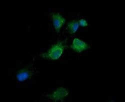 KLK8 Monoclonal Antibody (OTI14E11), TrueMAB , OriGene 100 &mu;L; Unconjugated:Antibodies,