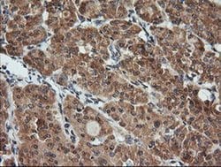 KLK8 Monoclonal Antibody (OTI10D3), TrueMAB , OriGene 100 &mu;L; Unconjugated:Antibodies,