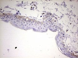 KLK8 Monoclonal Antibody (OTI3G5), TrueMAB , OriGene 30 &mu;L; Unconjugated:Antibodies,