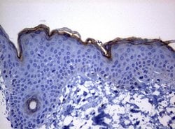 KLK8 Monoclonal Antibody (OTI10F9H3), TrueMAB , OriGene:Antibodies:Primary