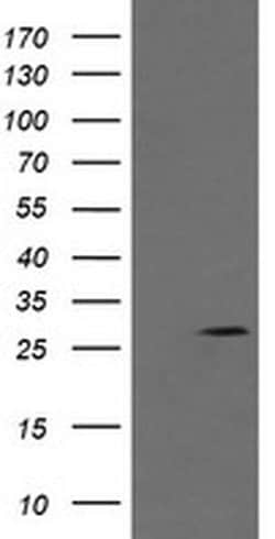 KLK8 Monoclonal Antibody (OTI10D3), TrueMAB , OriGene 100 &mu;L; Unconjugated:Antibodies,