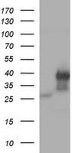 KLK8 Mouse anti-Human, Clone: OTI6F4, lyophilized, TrueMAB 100 &mu;g | Buy Online | Origene Technologies | Fisher Scientific