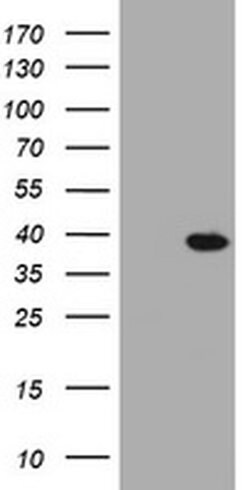 KLK8 Monoclonal Antibody (OTI3E6), TrueMAB , OriGene:Antibodies:Primary