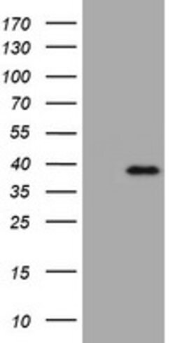 KLK8 Mouse anti-Human, Clone: OTI5D1, lyophilized, TrueMAB 100 &mu;g; Unconjugated:Antibodies,