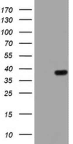 KLK8 Mouse anti-Human, Clone: OTI1E2, lyophilized, TrueMAB 100 &mu;g; Unconjugated:Antibodies,