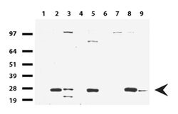 KLK8 Mouse anti-Human, Clone: UMAB84, lyophilized, UltraMAB 100 &mu;g;