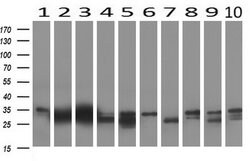 KLK8 Mouse anti-Human, Clone: UMAB84, liquid, UltraMAB 30 &mu;L; Unconjugated:Antibodies,