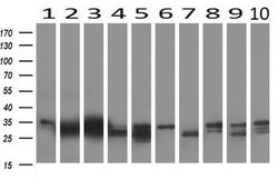 KLK8 Mouse anti-Human, Clone: UMAB84, lyophilized, UltraMAB 100 &mu;g;