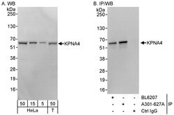 KPNA4 Rabbit anti-Human, Polyclonal, Bethyl Laboratories 100 &mu;L; Unconjugated:Antibodies,
