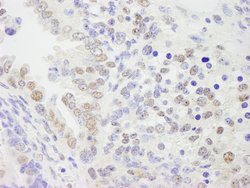 KPNA4 Polyclonal Antibody, Bethyl Laboratories 100 &mu;L; Unconjugated:Antibodies,