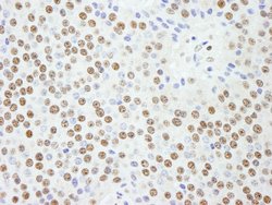 KPNA4 Polyclonal Antibody, Bethyl Laboratories 100 &mu;L; Unconjugated:Antibodies,