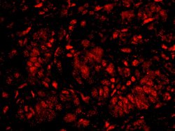 KPNA4 Polyclonal Antibody, Bethyl Laboratories 100 &mu;L; Unconjugated:Antibodies,