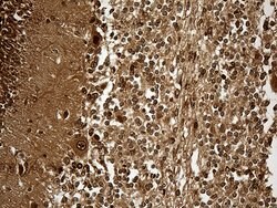KPNB1 Monoclonal Antibody (OTI10B7), TrueMAB , OriGene 100 &mu;L; Unconjugated:Antibodies,