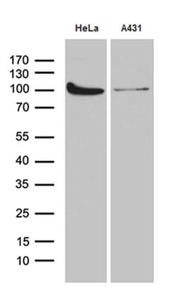 KPNB1 Monoclonal Antibody (OTI10D3), TrueMAB , OriGene:Antibodies:Primary